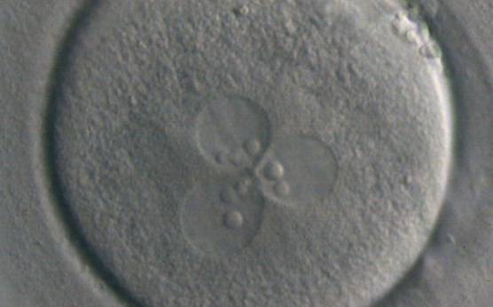 <p><strong>Figure 95</strong></p>

<p>A zygote displaying 3PNs with large-sized NPBs (400× magnification). One of the three PNs is slightly bigger than the others. The zygote was generated by ICSI performed on a giant oocyte.</p>