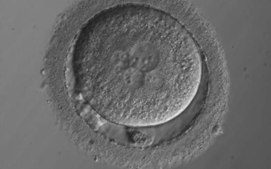 <p><strong>Figure 97</strong></p>

<p>A zygote with 5PNs, halo cytoplasm, fragmented polar bodies, oval shape and dark ZP (400× magnification). It was warmed after vitrification.</p>