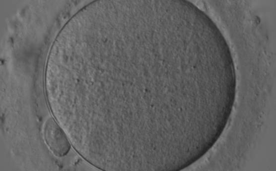 <p><strong>Figure 10</strong></p><p>Denuded MII oocyte; an intact PBI is clearly visible in the PVS (400× magnification).</p>