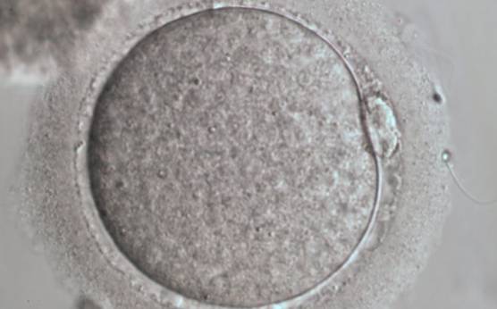 <p><strong>Figure 11</strong></p><p>Denuded MII oocyte; the PBI is clearly visible in the narrow PVS (400× magnification).</p>