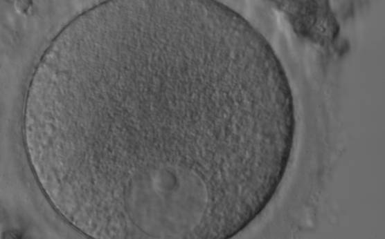 <p><strong>Figure 12</strong></p><p>Denuded GV oocyte. A typical GV oocyte with an eccentrically placed nucleus and a prominent single nucleolus (400× magnification).</p>