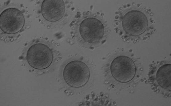 <p><strong>Figure 13</strong></p><p>Denuded GV oocytes. Several GV with the organelles condensed centrally within the cytoplasm (200× magnification).</p>