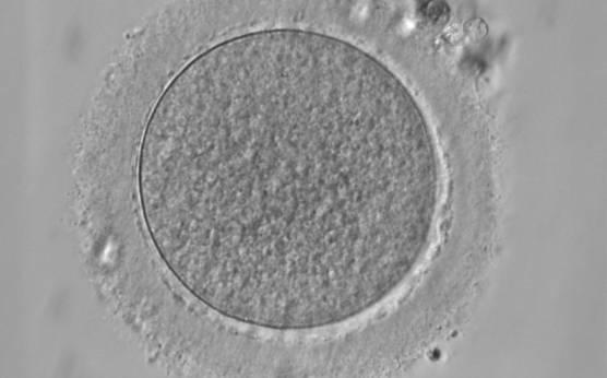 <p><strong>Figure 15</strong></p><p>Denuded MI oocyte. This oocyte has no visible nucleus and has not as yet extruded the PBI (400× magnification). PVS is typically narrow.</p>